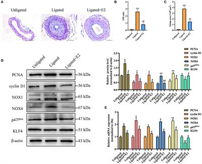 17β-Estradiol Inhibits Proliferation and Oxidative Stress in Vascular Smooth Muscle Cells by Upregulating BHLHE40 Expression